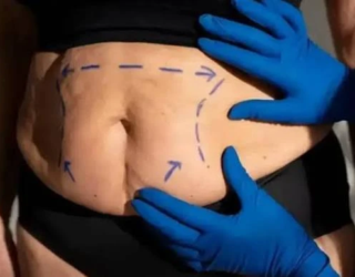 cirurgia plastica