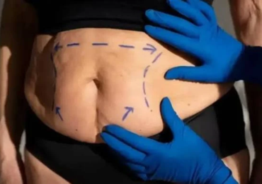 cirurgia plastica