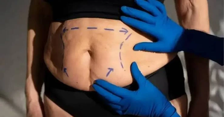 cirurgia plastica