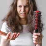 queda de cabelo