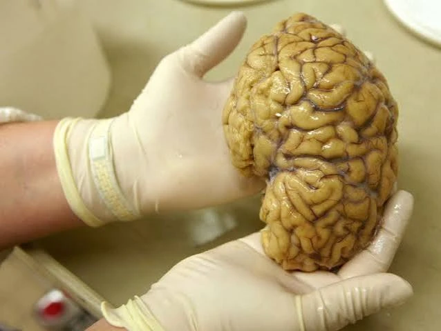 cerebro